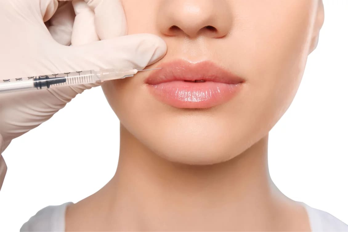 Natürlich sinnliche Lippen mit Lippen Aufspritzen Nürnberg
